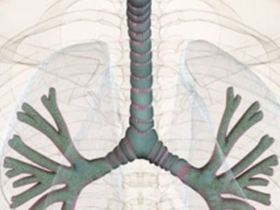 La tosse in medicina